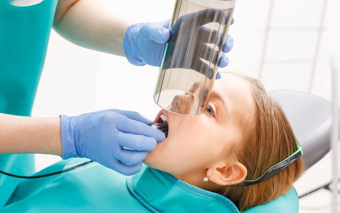 Dental Sensors